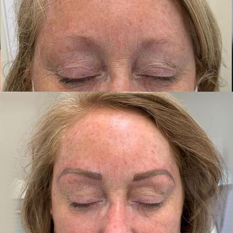 Example nanobrow work by Victoria Images of before and after nanobrow work by Victoria